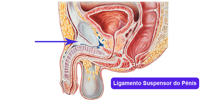 faloplastia - aumento peniano Veja como milhares de homens estão conseguindo financiar a Faloplastia